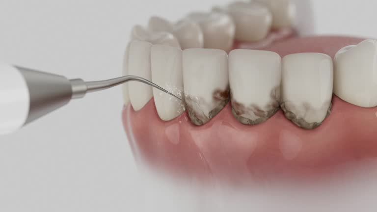 Trusted Teeth Cleaning And Checkup service in Bacliff, TX - Dentist Open Now